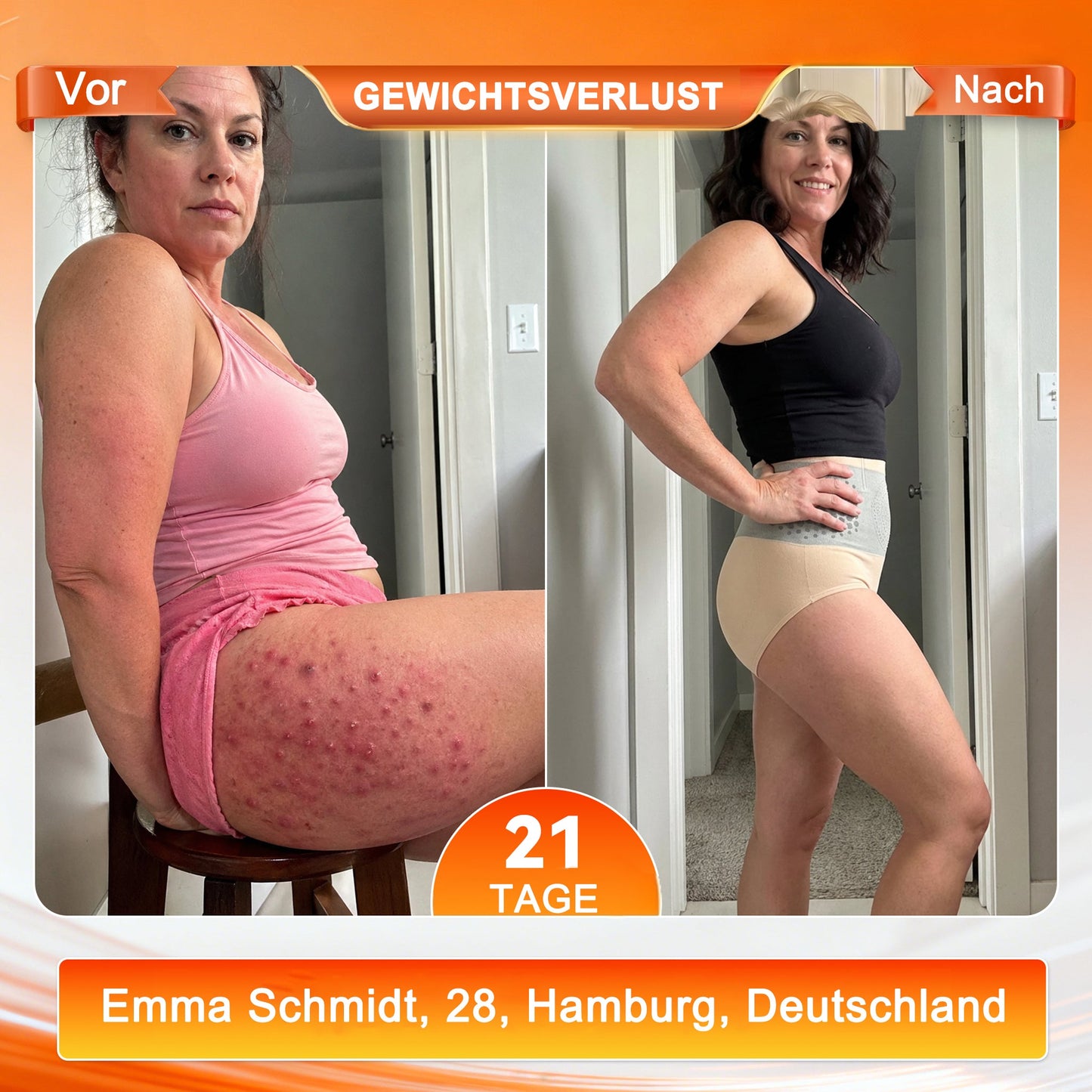 Nur noch 5 Stück auf Lager! Profitieren Sie sofort von 30 % Rabatt! Bringen Sie sich in Form und bleiben Sie gesund. Achtung: Wenn Sie dieses Angebot verpassen, müssen Sie bis zum nächsten Jahr warten.